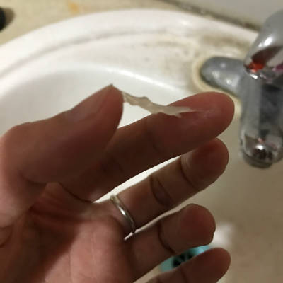 请问排卵期的白带有15公分左右,但测排卵测试纸还是一深一浅,请问什麼