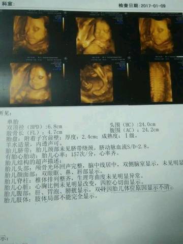 journal_insert_pic_645504686