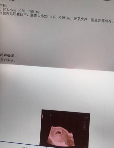 journal_insert_pic_645453740