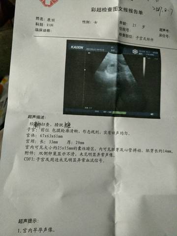 journal_insert_pic_646709313