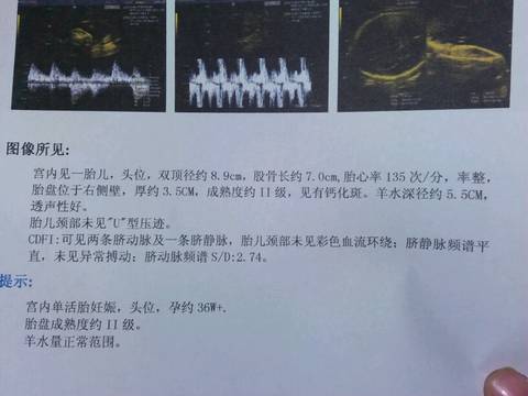 journal_insert_pic_646901319