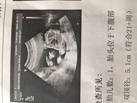journal_insert_pic_646850023