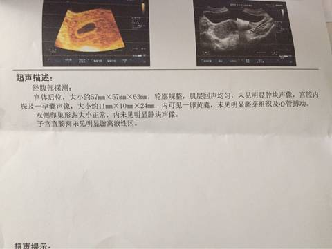 journal_insert_pic_649587482