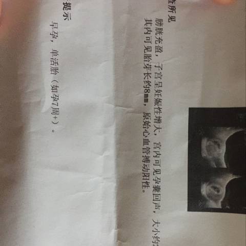 journal_insert_pic_654012625