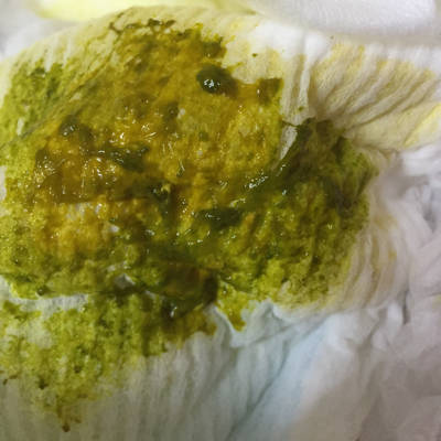 宝宝三个月了,一直大便都很好,刚才换尿不湿吓一跳,有没有宝妈遇到过