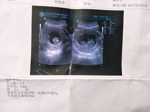 journal_insert_pic_660295847