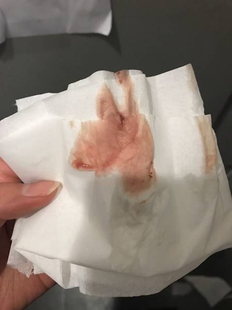 孕两月多小便擦出来血,请问你们有这种情况吗