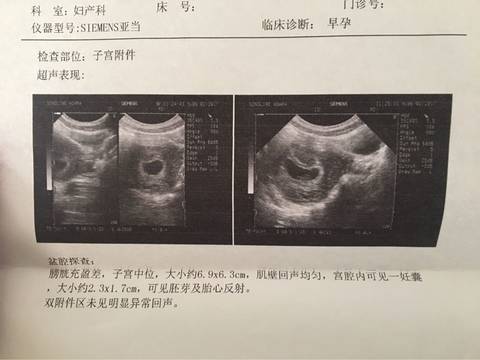 journal_insert_pic_664299170