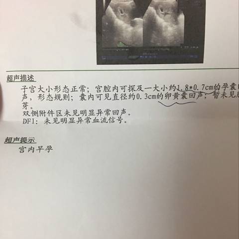 journal_insert_pic_665491496