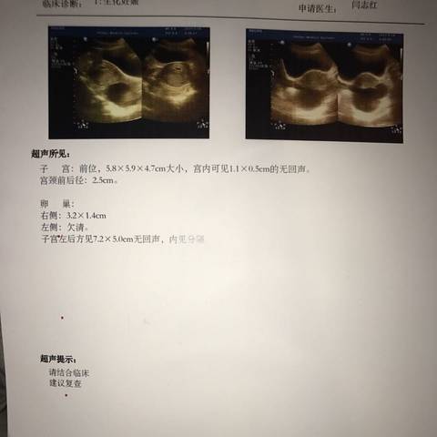 journal_insert_pic_667785417