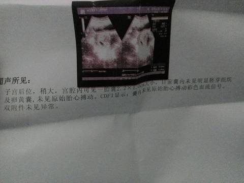 journal_insert_pic_674665645
