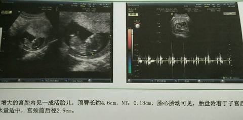 journal_insert_pic_675140298