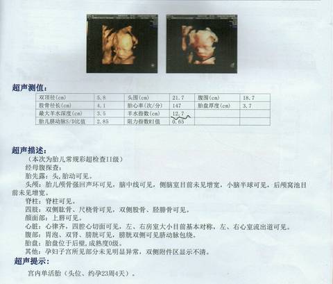 journal_insert_pic_674899799