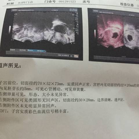 journal_insert_pic_675451228