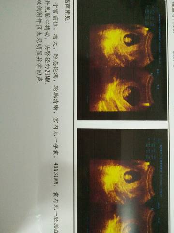 journal_insert_pic_676124779