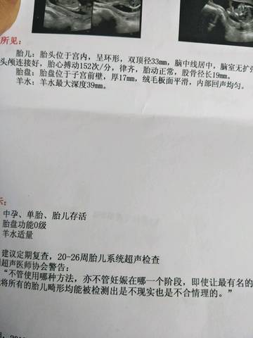 journal_insert_pic_676628909