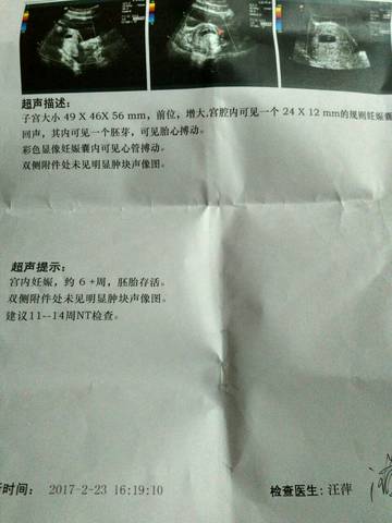 journal_insert_pic_678877278