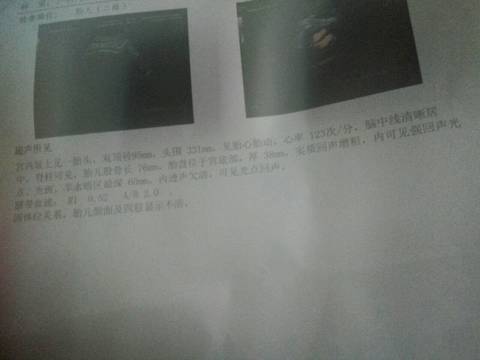 journal_insert_pic_679600109