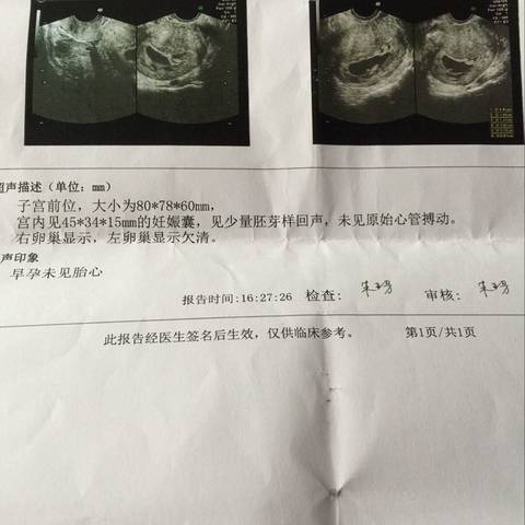 journal_insert_pic_680997607