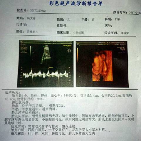 journal_insert_pic_681890940