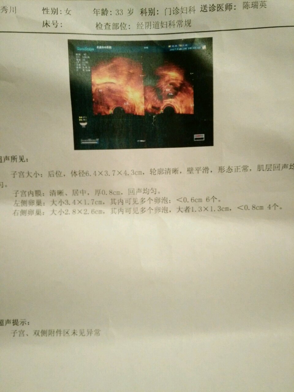 子宫内膜薄