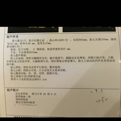 今天剛做了四維,但醫生說是球拍狀胎盤,建議做dna.但孕周過了,很糾結