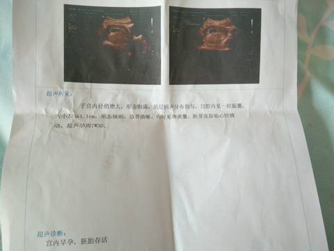 journal_insert_pic_684879226