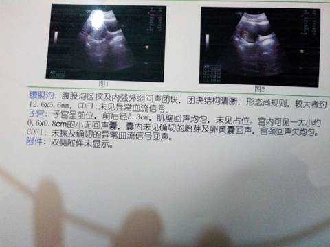 journal_insert_pic_685059549