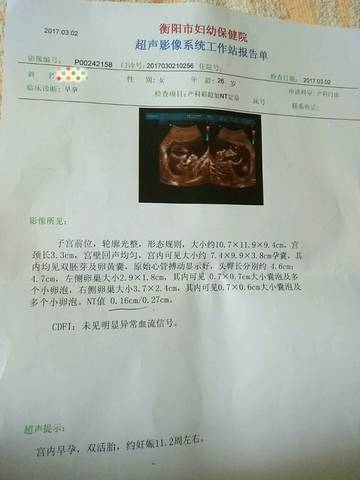 journal_insert_pic_685084955