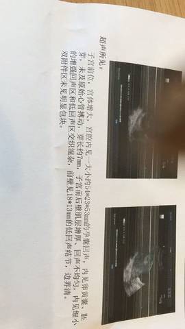 journal_insert_pic_688253427