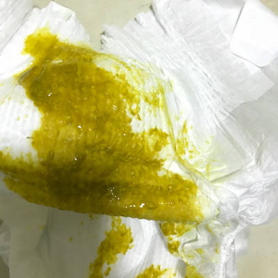 我家小家伙拉大便有点粘液(就是启悬丝那样),大便不干也不稠,喝的是