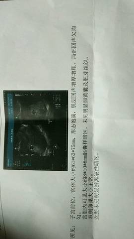 journal_insert_pic_689532278