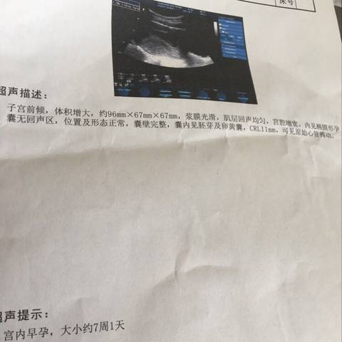 journal_insert_pic_690840541