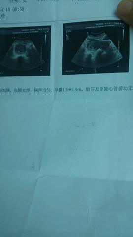 journal_insert_pic_694662112