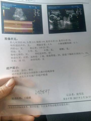 journal_insert_pic_695692183