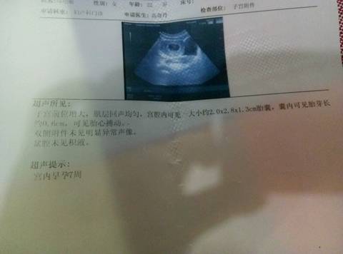 journal_insert_pic_695639404