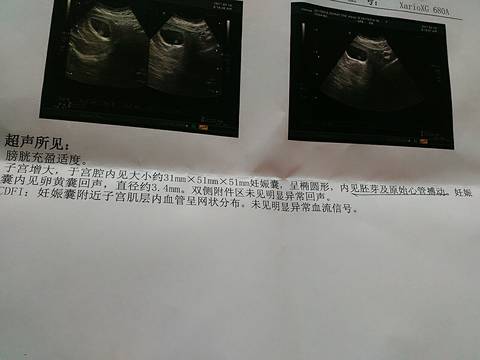 journal_insert_pic_697034080