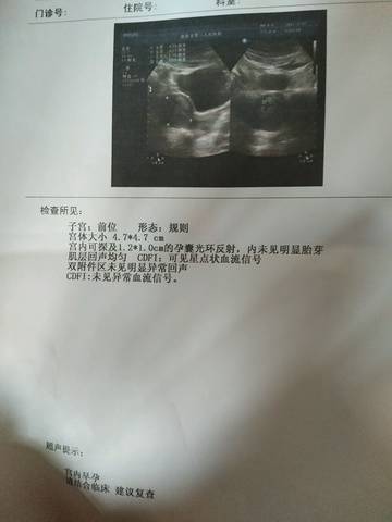 journal_insert_pic_698847085