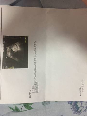 journal_insert_pic_699554157