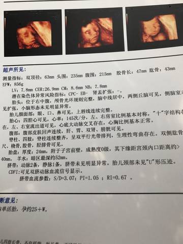 journal_insert_pic_702287208
