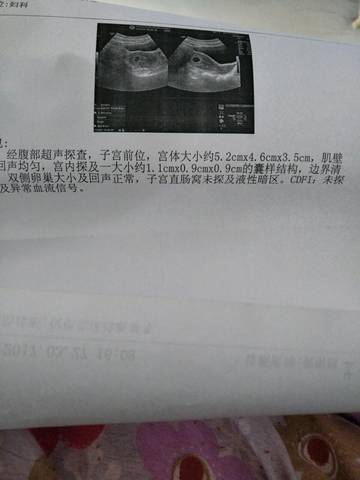 journal_insert_pic_703240167