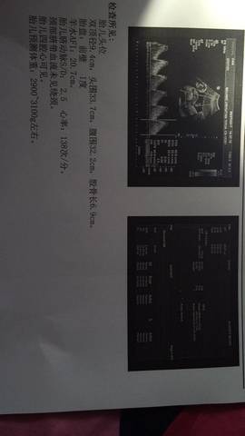 journal_insert_pic_704584418