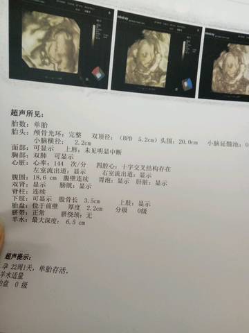 journal_insert_pic_706188627