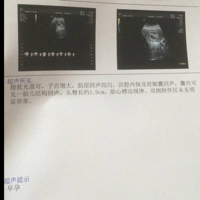 journal_insert_pic_706471364