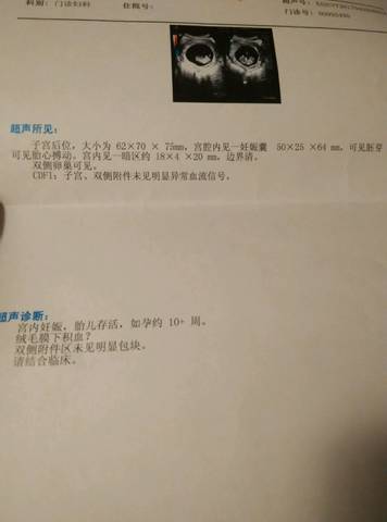 绒毛膜下积血先兆流产 宝宝树