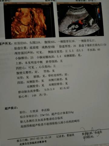 journal_insert_pic_708791282