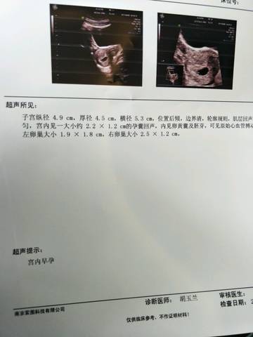 journal_insert_pic_710174715