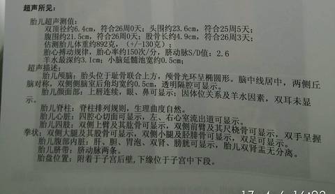journal_insert_pic_711310289