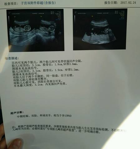 journal_insert_pic_711827342