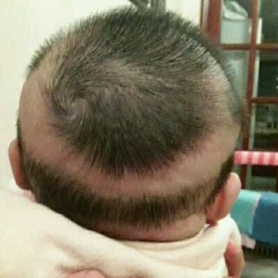 婴儿发型图片三个月图片